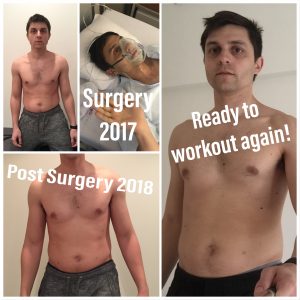 post surgery 2018