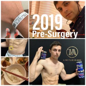 cutting pre surgery